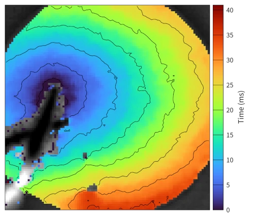 Activation Map