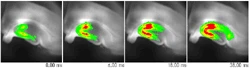 Real-Time Imaging of Action Potential Propagation with Single Scan